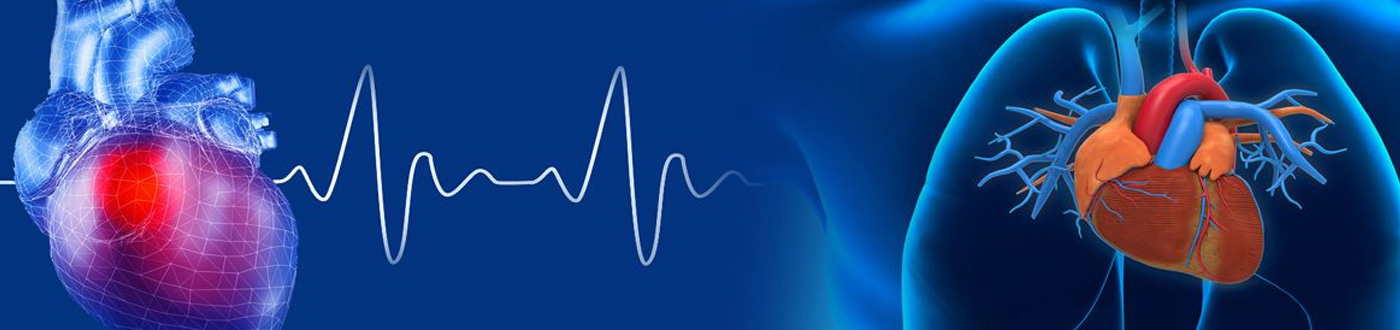 Cardiology Equipment Manufacturers India