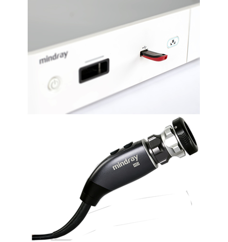 Endoscope HD3 Chip Camera System Manufacturers India