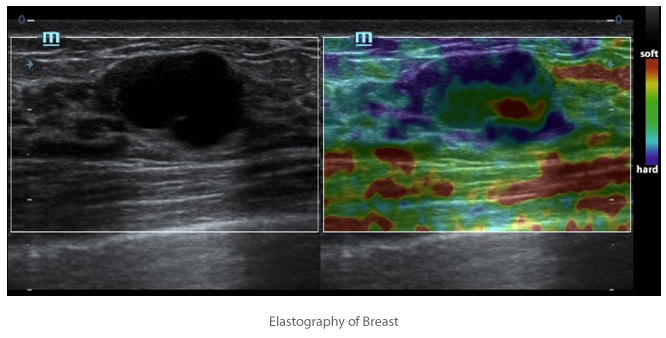Natural Touch Elastography