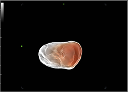 Superb visualization with Hyaline